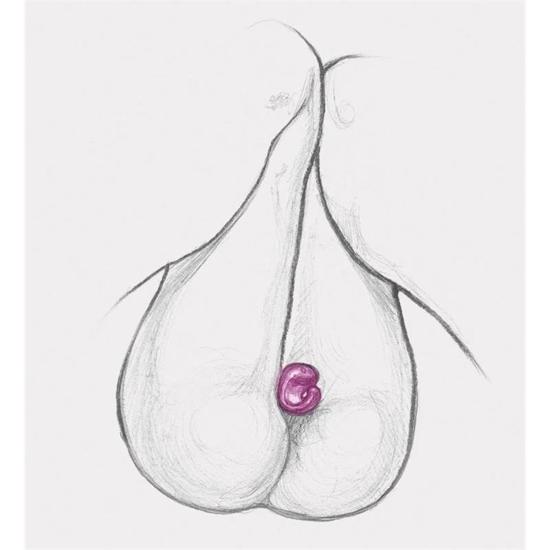 Gring XL Sweet Raspberry - Image 7